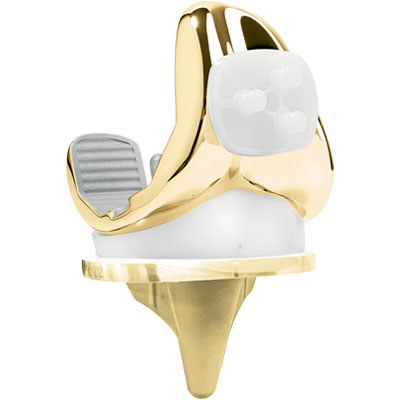 Prothèses orthopédiques